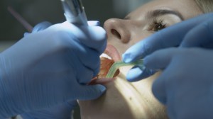 Dental Procedure